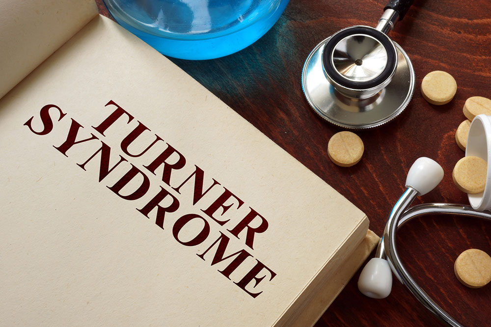 Turner Syndrome – Causes, Symptoms, and Management